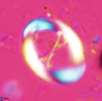 Neochiastozygus junctus 24748