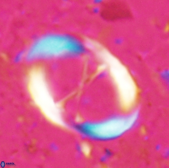Neochiastozygus junctus 24768