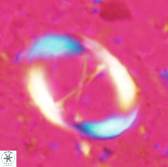Neochiastozygus junctus 24768