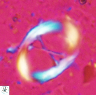 Neochiastozygus junctus 24772