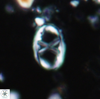 Neochiastozygus perfectus 1520