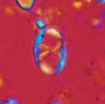 Neochiastozygus perfectus 1521
