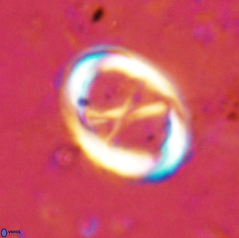 Neochiastozygus perfectus 50026