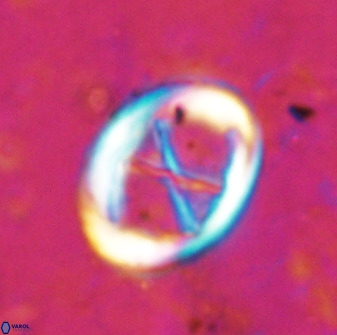 Neochiastozygus perfectus 50022