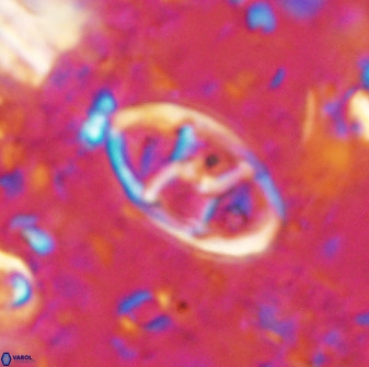 Neococcolithes dubius 49067