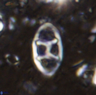 Neococcolithes dubius 49069