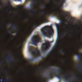 Neococcolithes dubius 49070