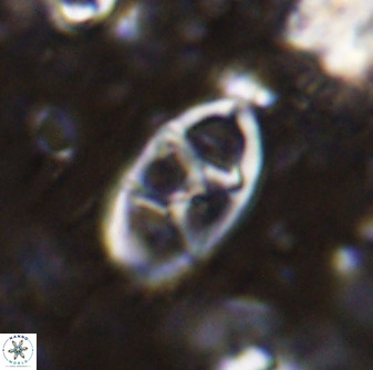 Neococcolithes dubius 49070