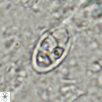 Neococcolithes dubius 49071