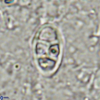 Neococcolithes dubius 49072