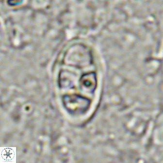 Neococcolithes dubius 49072