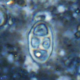 Neococcolithes dubius 49073