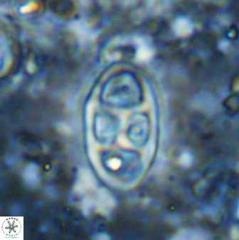 Neococcolithes dubius 49073