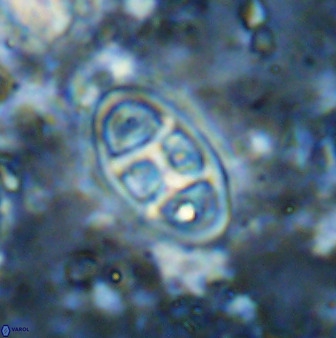Neococcolithes dubius 49074