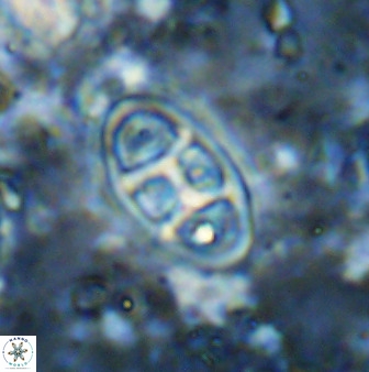 Neococcolithes dubius 49074
