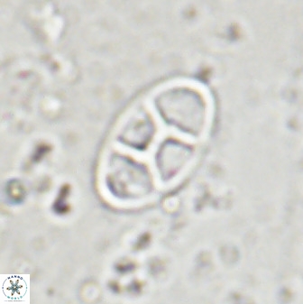 Neococcolithes dubius 49238