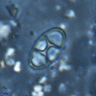 Neococcolithes dubius 49239