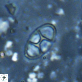 Neococcolithes dubius 49239