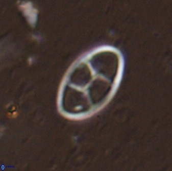 Neococcolithes dubius 49241