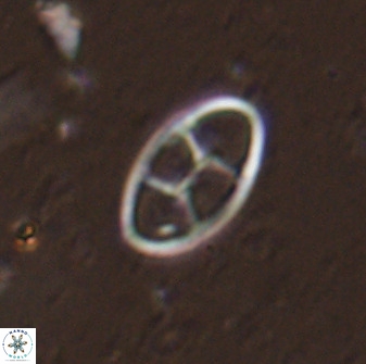 Neococcolithes dubius 49241