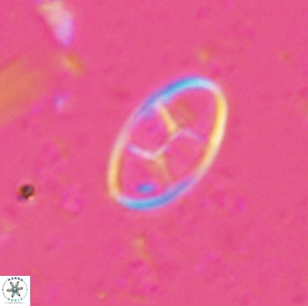 Neococcolithes dubius 49242