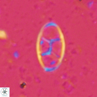 Neococcolithes dubius 49243