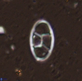 Neococcolithes dubius 49244