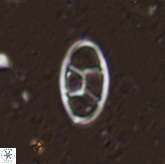 Neococcolithes dubius 49244