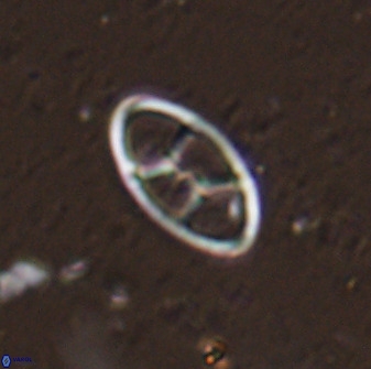 Neococcolithes dubius 49245