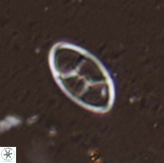 Neococcolithes dubius 49245