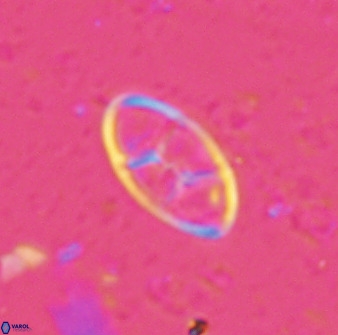 Neococcolithes dubius 49246