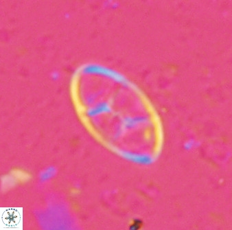 Neococcolithes dubius 49246