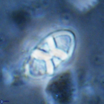 Neococcolithes dubius VR 03085