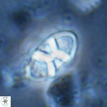 Neococcolithes dubius VR 03085