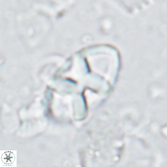 Neococcolithes dubius VR 03087
