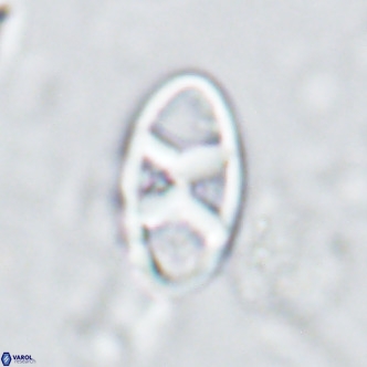 Neococcolithes dubius VR 03088