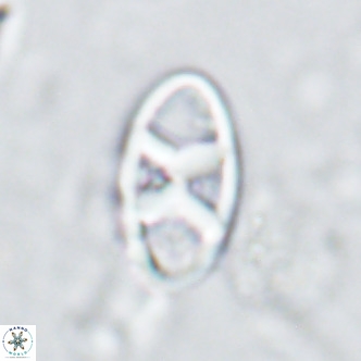 Neococcolithes dubius VR 03088