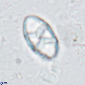Neococcolithes dubius VR 03089