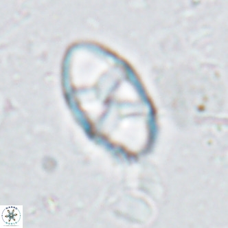 Neococcolithes dubius VR 03089