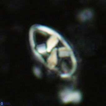 Neococcolithes dubius VR 03090