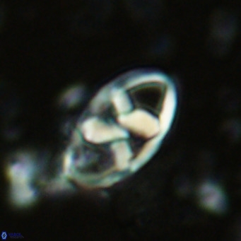 Neococcolithes dubius VR 03094
