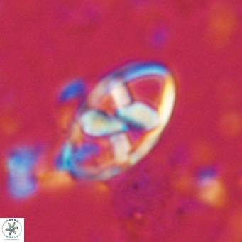 Neococcolithes dubius VR 03095