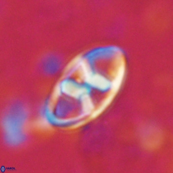 Neococcolithes dubius VR 03096