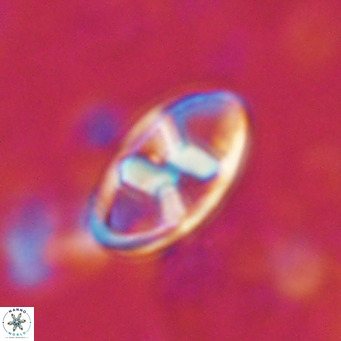 Neococcolithes dubius VR 03096