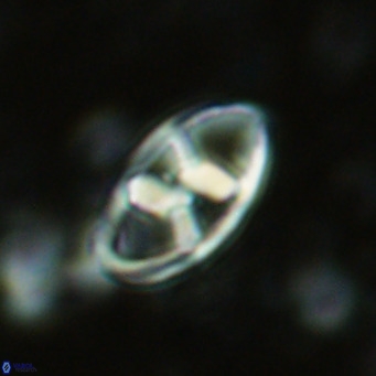 Neococcolithes dubius VR 03097