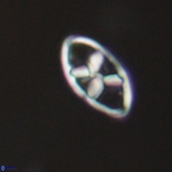Neococcolithes dubius VR 30841
