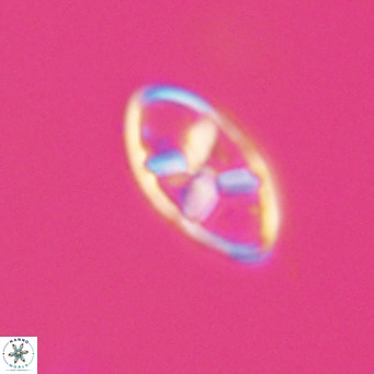 Neococcolithes dubius VR 30843