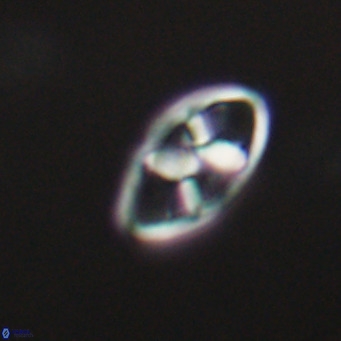 Neococcolithes dubius VR 30847