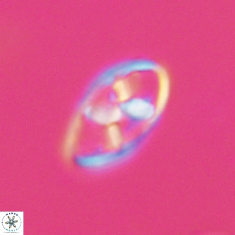 Neococcolithes dubius VR 30848