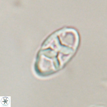 Neococcolithes dubius VR 30849